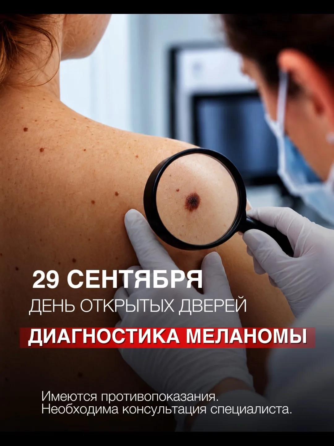 Диагностика меланомы